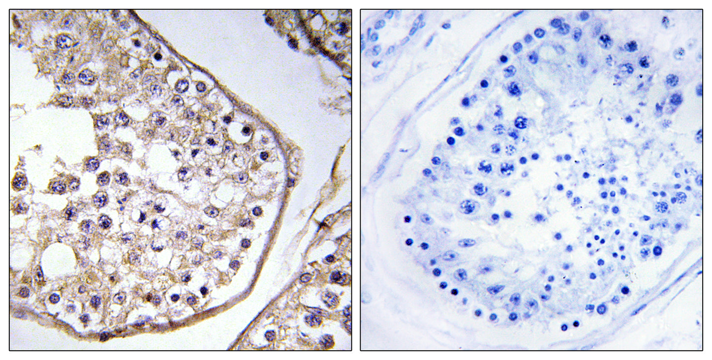 BAGE3 Rabbit Polyclonal Antibody