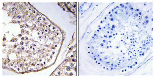 BAGE3 Rabbit Polyclonal Antibody