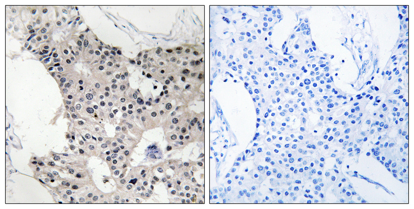 BAGE4 Rabbit Polyclonal Antibody