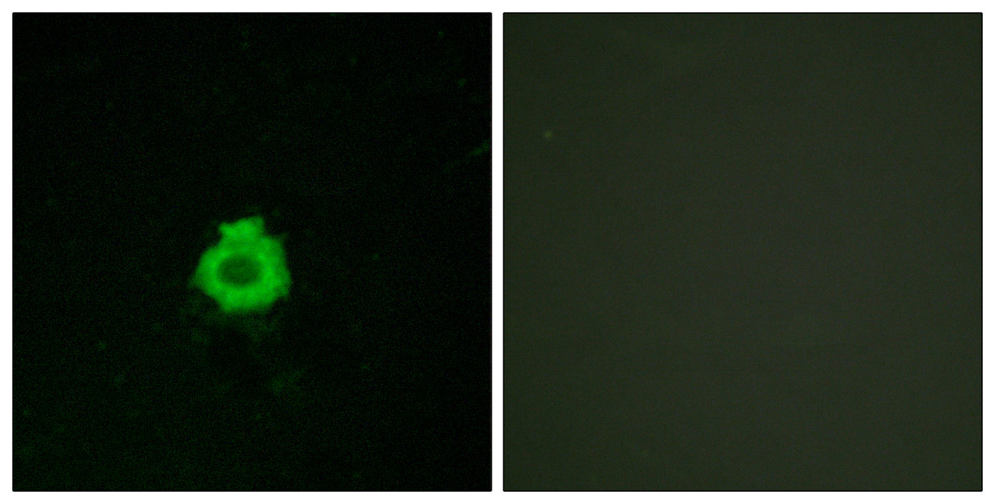 BAI-2 Rabbit Polyclonal Antibody