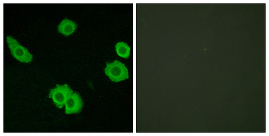 BAI-3 Rabbit Polyclonal Antibody