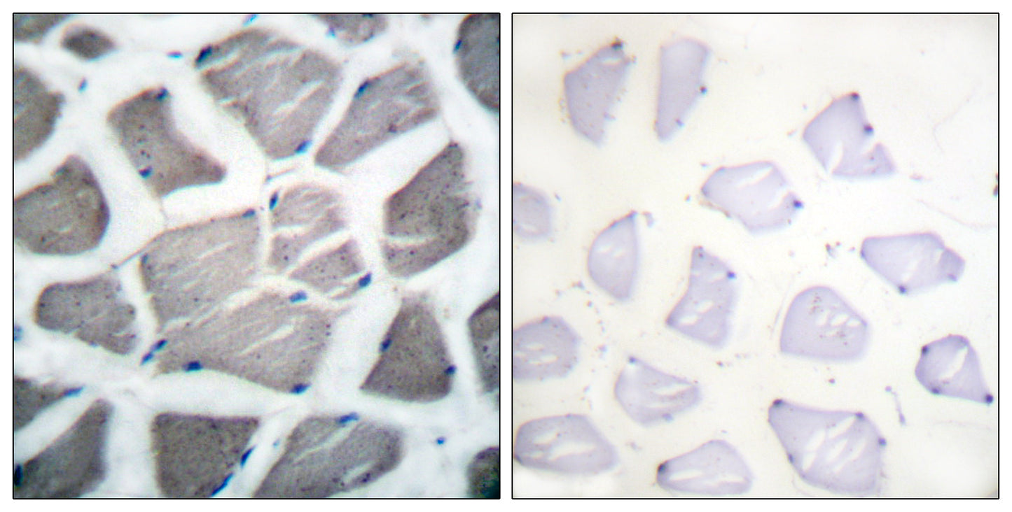Bak Rabbit Polyclonal Antibody