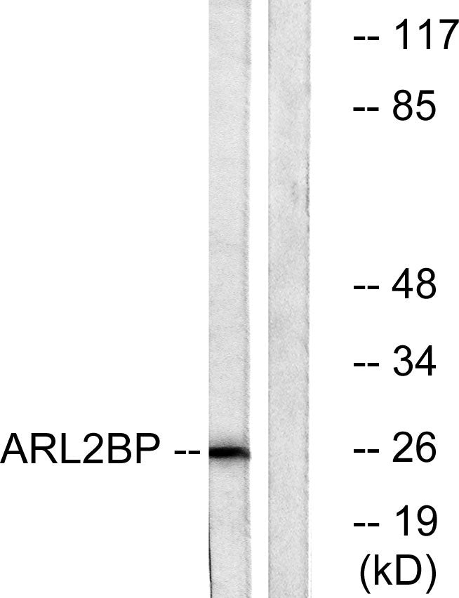 BART1 Rabbit Polyclonal Antibody