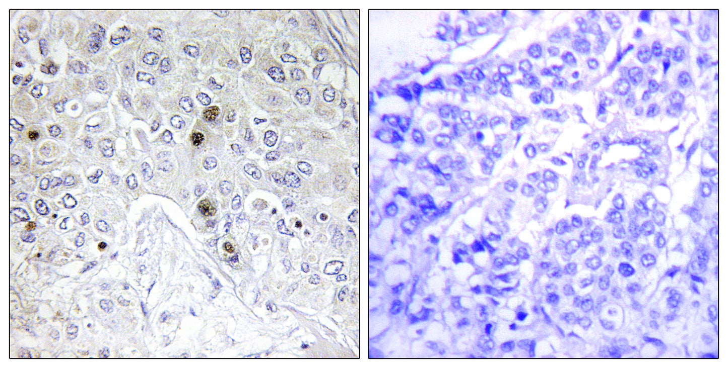 B-ATF Rabbit Polyclonal Antibody