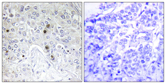 B-ATF Rabbit Polyclonal Antibody
