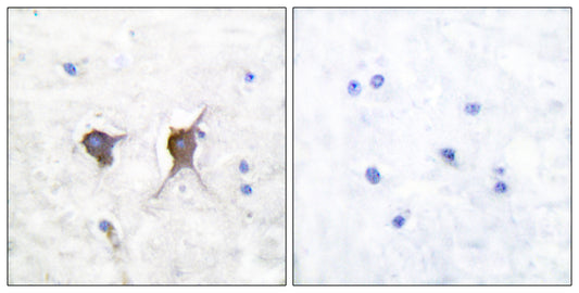 Bax Rabbit Polyclonal Antibody