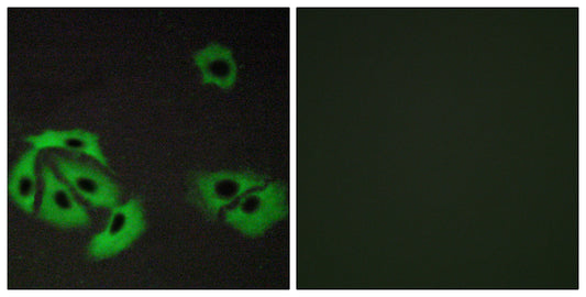 Bax Rabbit Polyclonal Antibody