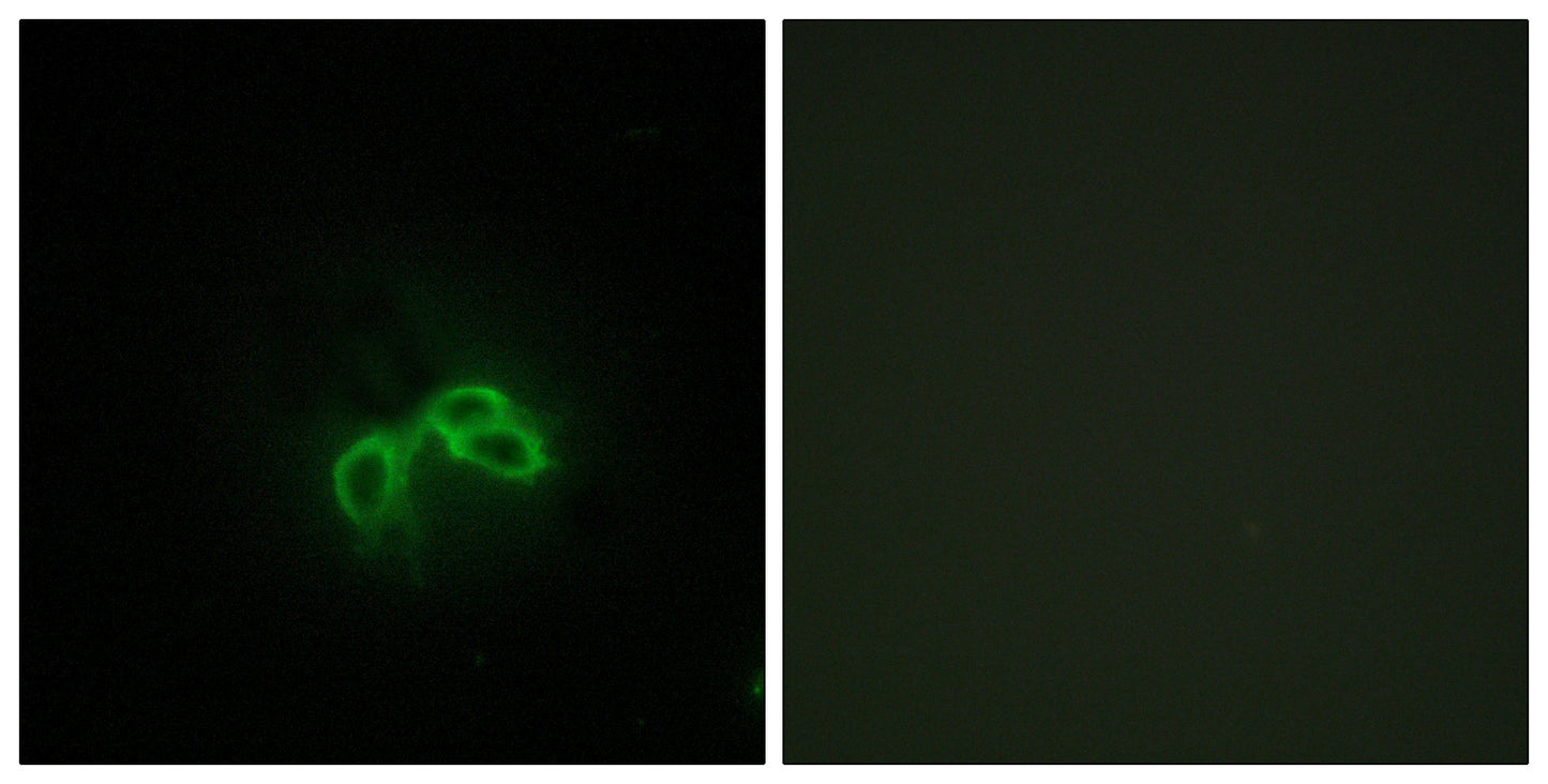 Bc10 Rabbit Polyclonal Antibody