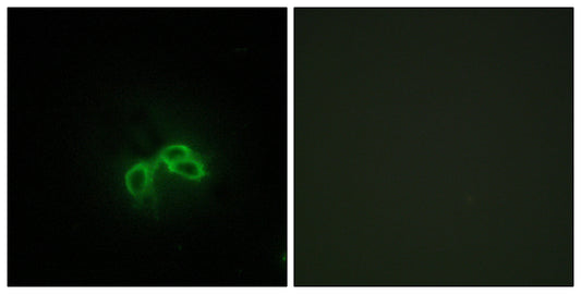 Bc10 Rabbit Polyclonal Antibody