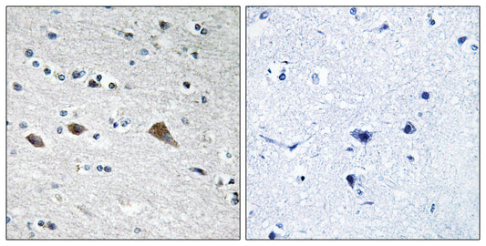 BCAR3 Rabbit Polyclonal Antibody