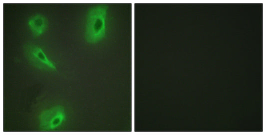 BCKDK Rabbit Polyclonal Antibody