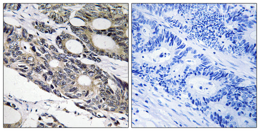 Bcl-10 Rabbit Polyclonal Antibody
