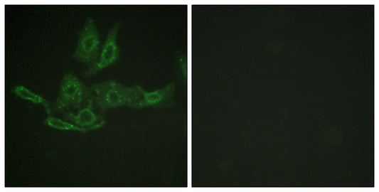 Bcl-2 Rabbit Polyclonal Antibody