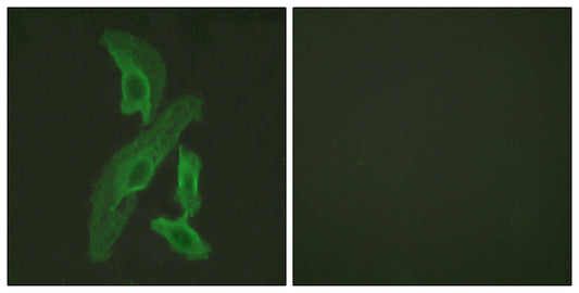 Bcl-x Rabbit Polyclonal Antibody