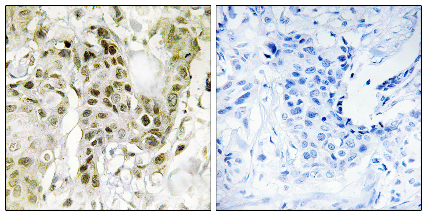 BCoR Rabbit Polyclonal Antibody