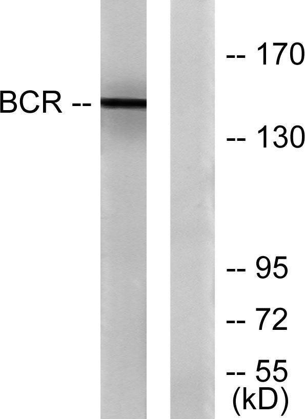 Bcr Rabbit Polyclonal Antibody