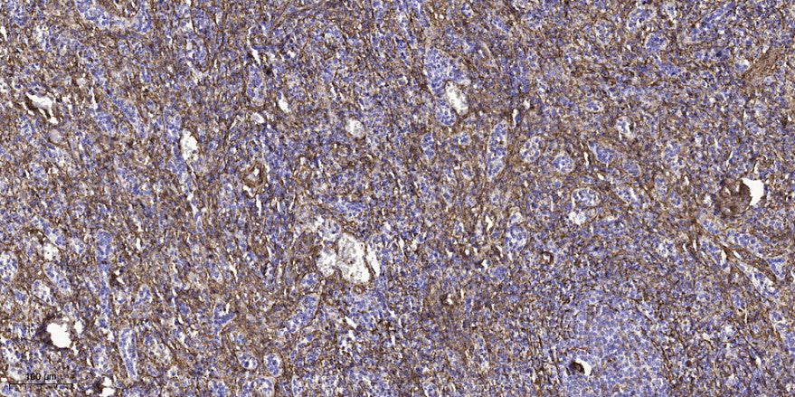 BD1L1 Rabbit Polyclonal Antibody