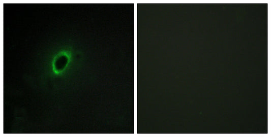 BEGAIN Rabbit Polyclonal Antibody