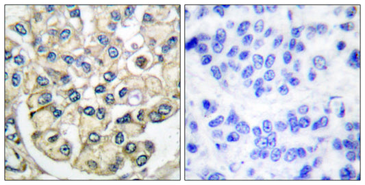 Bek Rabbit Polyclonal Antibody