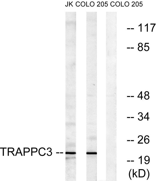 BET3 Rabbit Polyclonal Antibody