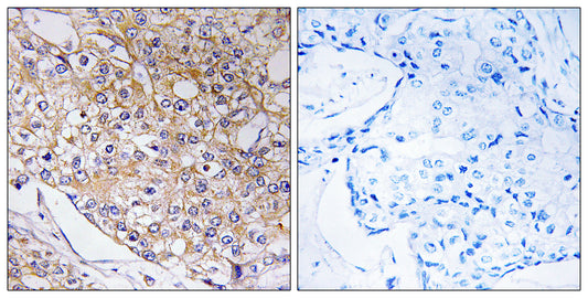 BET5 Rabbit Polyclonal Antibody