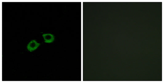 BIG2 Rabbit Polyclonal Antibody