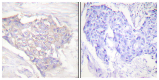 Bim Rabbit Polyclonal Antibody