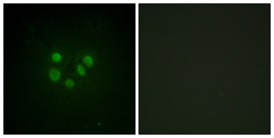 BLM Rabbit Polyclonal Antibody