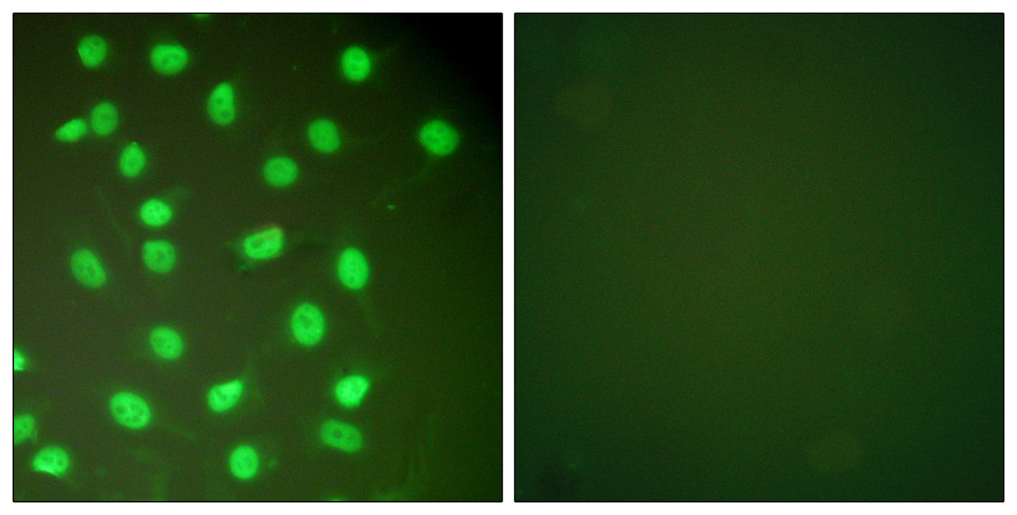 BM28 Rabbit Polyclonal Antibody