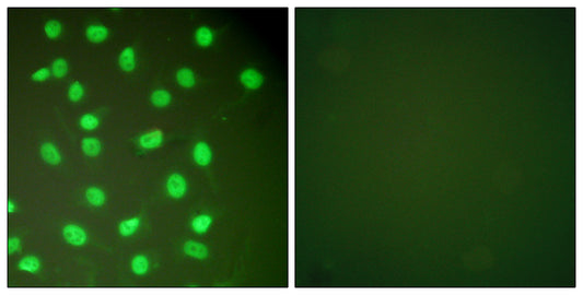 BM28 Rabbit Polyclonal Antibody