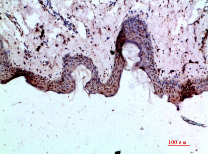 BMP-1 Rabbit Polyclonal Antibody