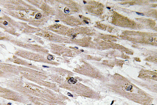 BMP-2 Rabbit Polyclonal Antibody