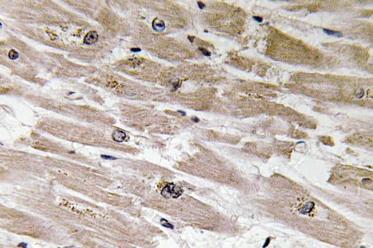 BMP-2 Rabbit Polyclonal Antibody