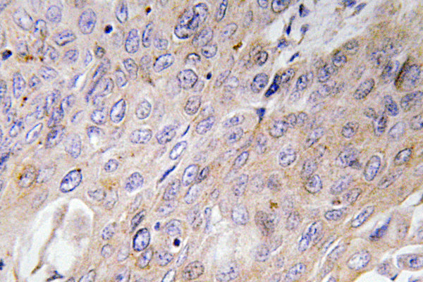 BMP-3 Rabbit Polyclonal Antibody