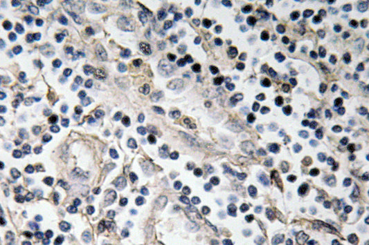 BMP-7 Rabbit Polyclonal Antibody