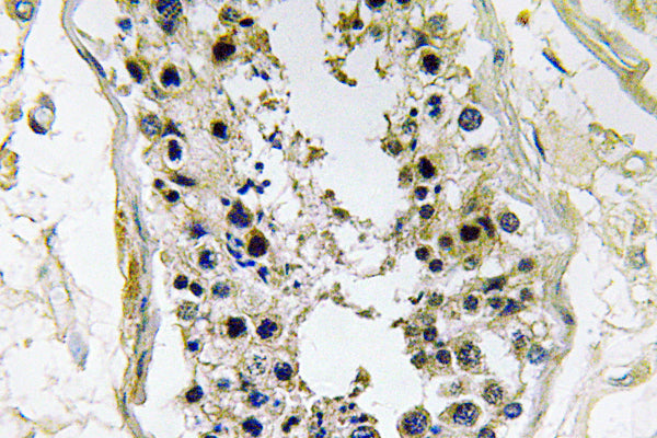 BMP-8 Rabbit Polyclonal Antibody