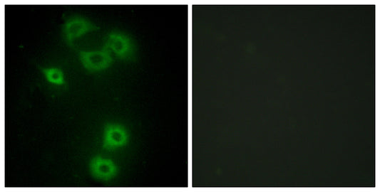Bmx Rabbit Polyclonal Antibody