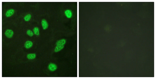 B-Myb Rabbit Polyclonal Antibody