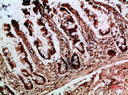Bob 1 Rabbit Polyclonal Antibody
