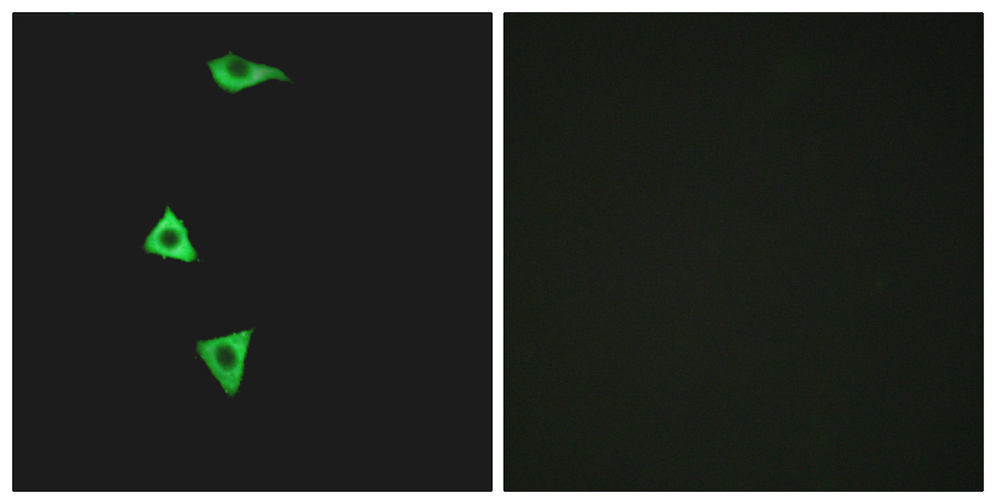 Bradykinin B1 R Rabbit Polyclonal Antibody