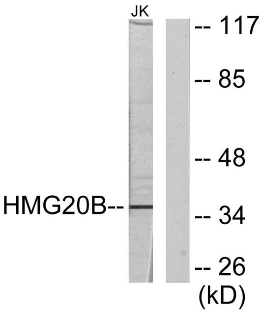 BRAF35 Rabbit Polyclonal Antibody