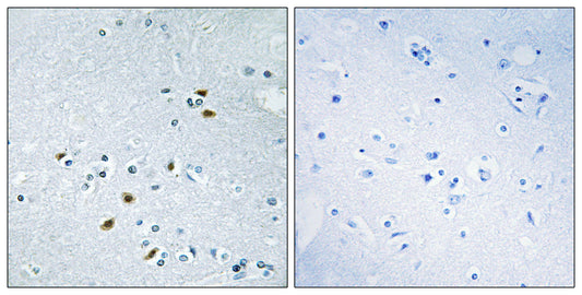 BRCA2 Rabbit Polyclonal Antibody