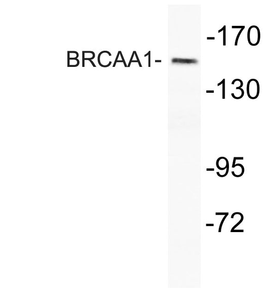 BRCAA1 Rabbit Polyclonal Antibody