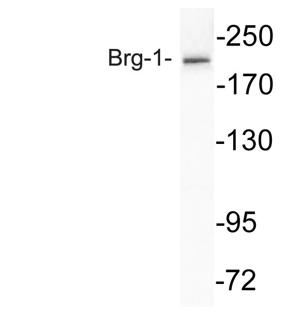 Brg-1 Rabbit Polyclonal Antibody