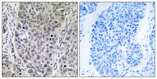 Brp16 Rabbit Polyclonal Antibody