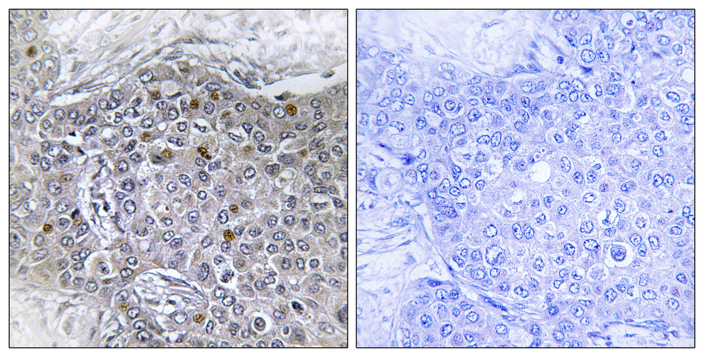 BS69 Rabbit Polyclonal Antibody