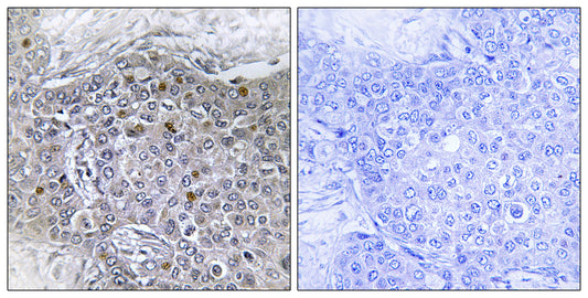 BS69 Rabbit Polyclonal Antibody