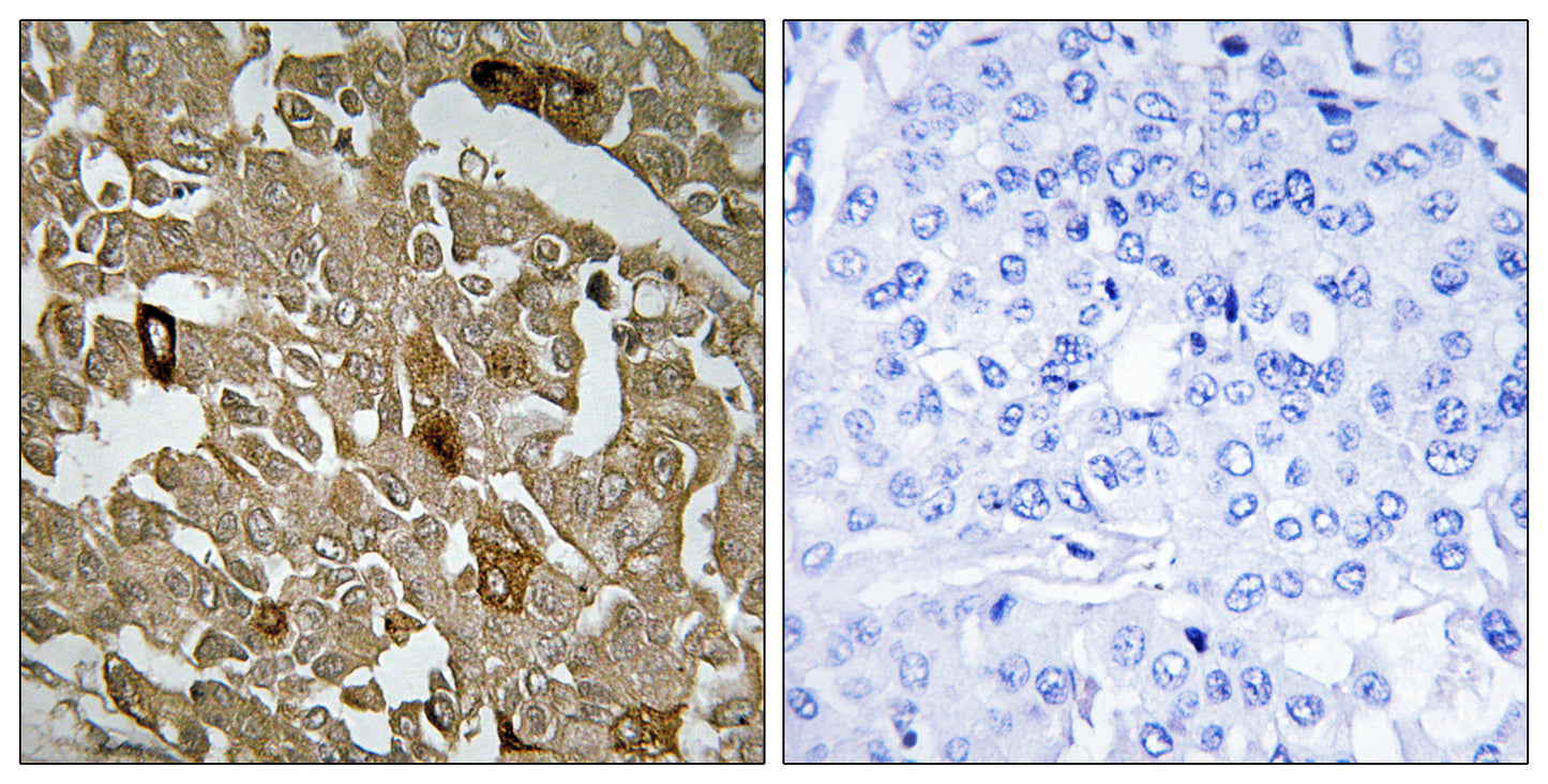 BTBD6 Rabbit Polyclonal Antibody