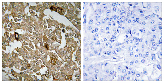BTBD6 Rabbit Polyclonal Antibody