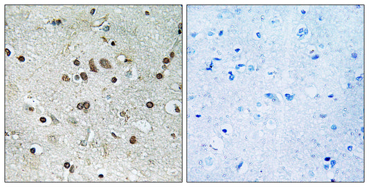 BTF3L4 Rabbit Polyclonal Antibody